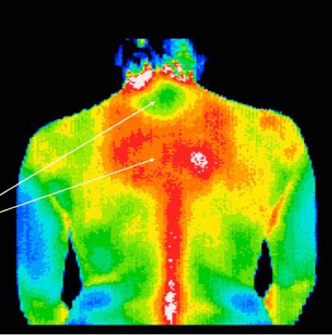 thermographic assessment