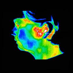 types of thermographic health scans